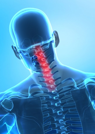Nackenschmerzen und ihre Ursachen